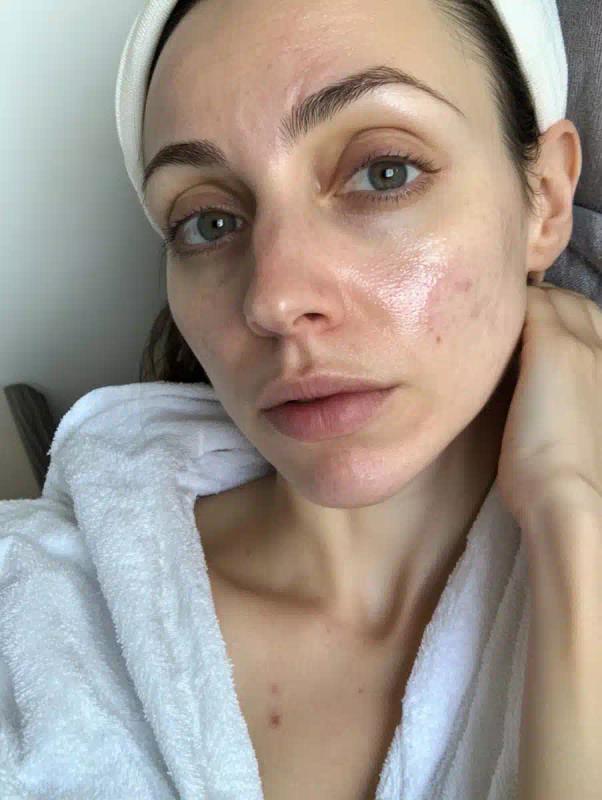 Casual iPhone Portrait of Skin